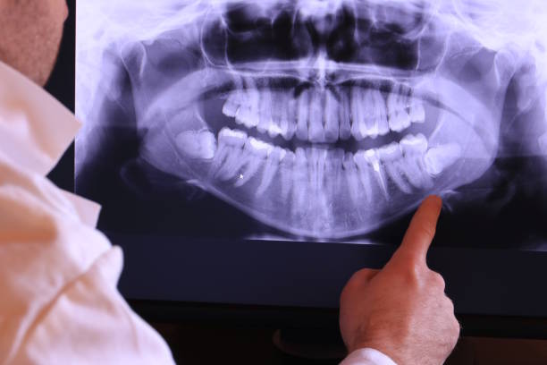 Reliable NM Emergency Dental Service Solutions