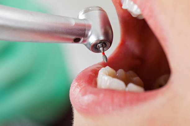 Best Broken or Chipped Tooth Repair in Atoka, NM